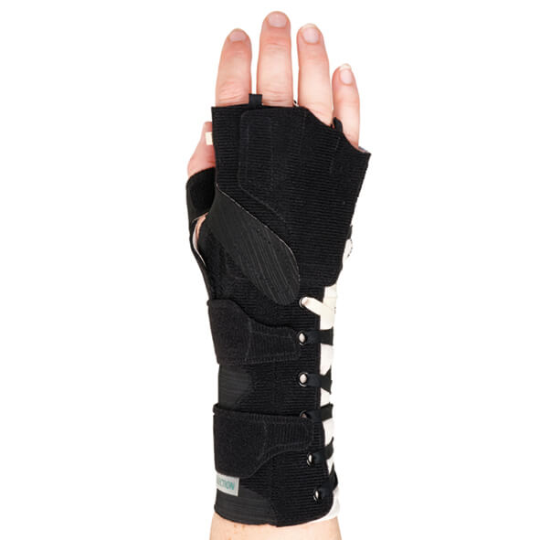 SELECTION® Radialis Sormiosa 